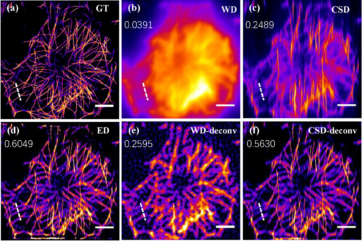 Overcoming tissue scattering in wide-field two-photon imaging by extended detection and computational reconstruction