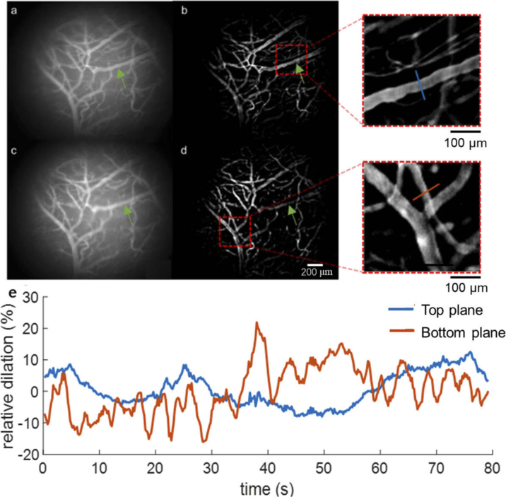 Multi-plane, wide-field fluorescent microscopy for biodynamic imaging in vivo