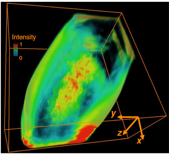 DiLFM: an artifact-suppressed and noise-robust light-field microscopy through dictionary learning