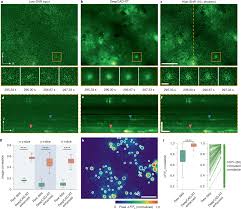 Real-time denoising enables high-sensitivity fluorescence time-lapse imaging beyond the shot-noise limit