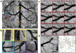Spinning Disk Multifocal Microscopy for Dynamic Arbitrarily Shaped Surface Imaging at Centimetre Scale and Micrometre Resolution