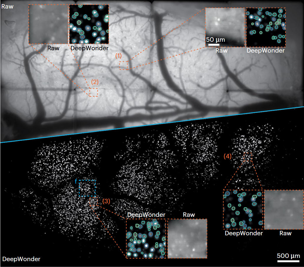 Rapid detection of neurons in widefield calcium imaging datasets after training with synthetic data